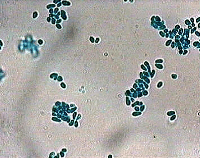 Bệnh nấm Malassezia pachydermatis.